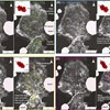 Stratigraphy, facies, and evolution of deep-water lobe complexes within a salt-controlled intraslope minibasin